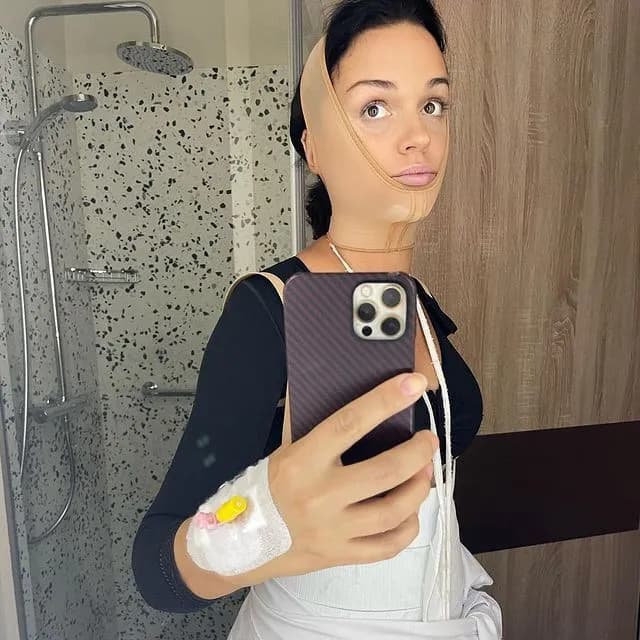 Слава решилась на пластику